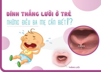 Tìm hiểu tật dính thắng lưỡi ở trẻ em và cách điều trị
