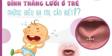 Tìm hiểu tật dính thắng lưỡi ở trẻ em và cách điều trị